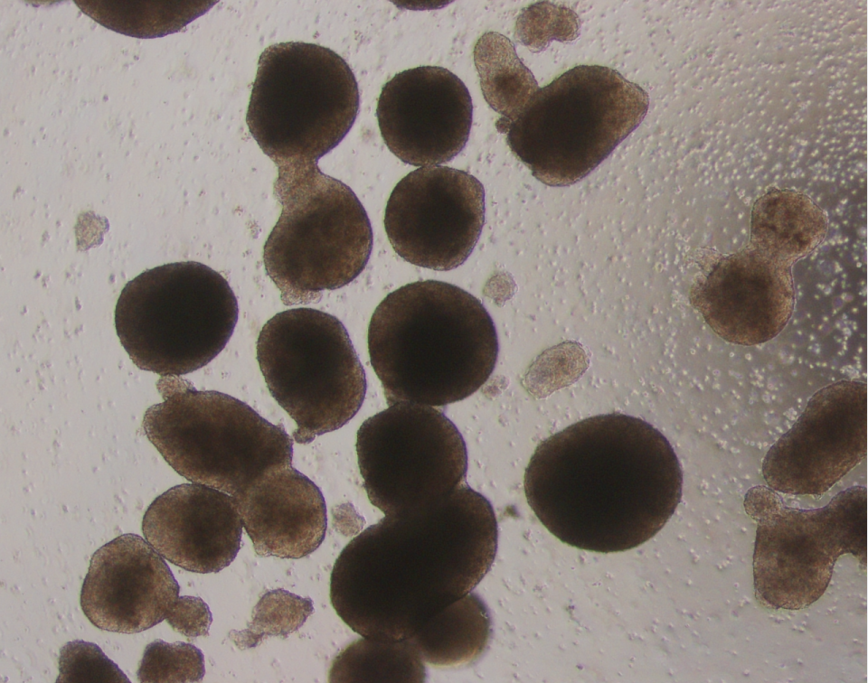 Spheroid clusters formed on an ultra-low-attachment culture surface